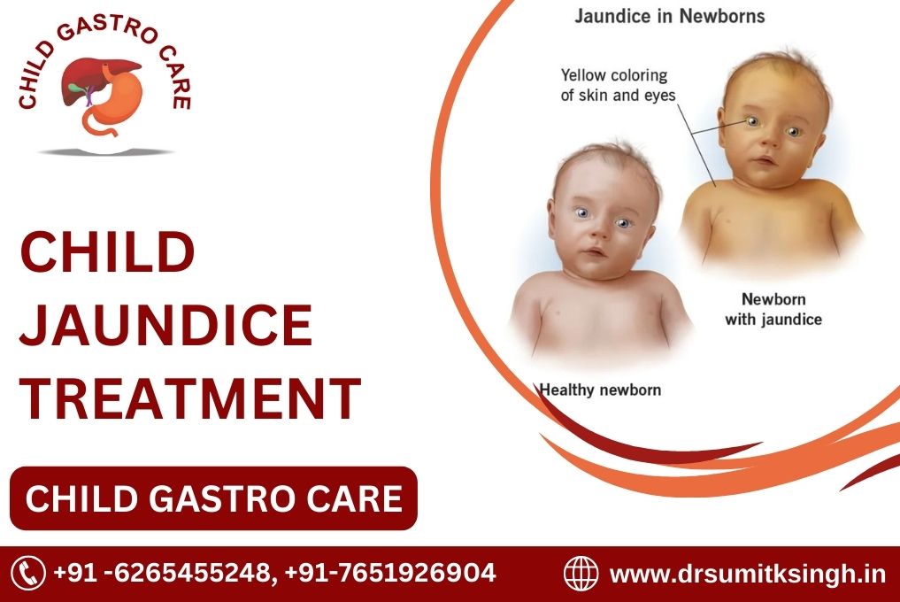 BEST CHILD JAUNDICE TREATMENT IN INDORE