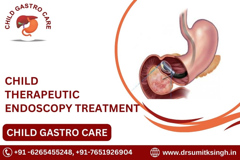 CHILD THERAPEUTIC ENDOSCOPY IN INDORE