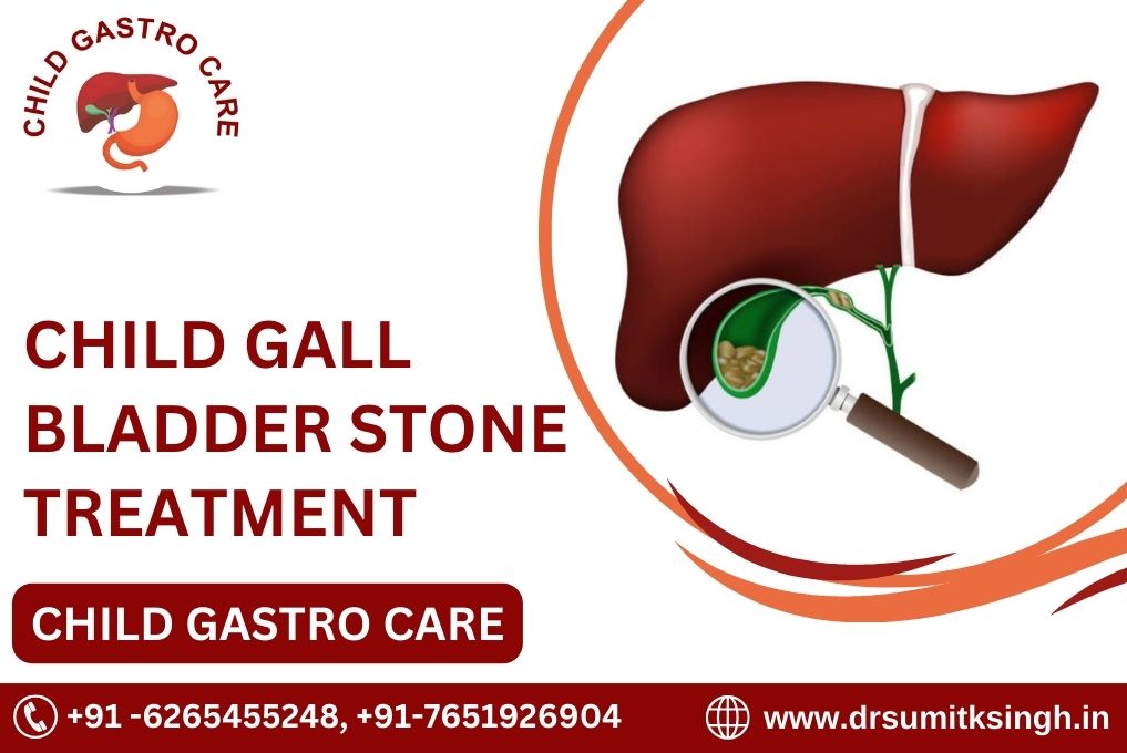 CHILD GALL BLADDER STONE TREATMENT IN INDORE