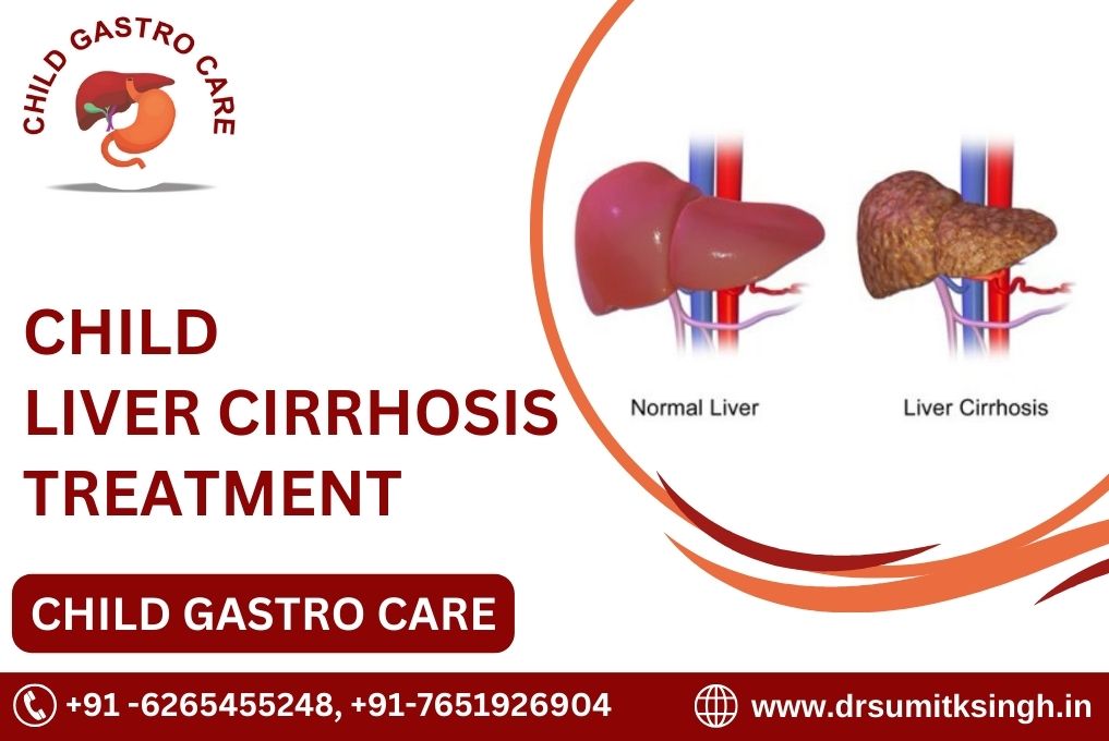 Child Liver Cirrhosis Treatment in Indore