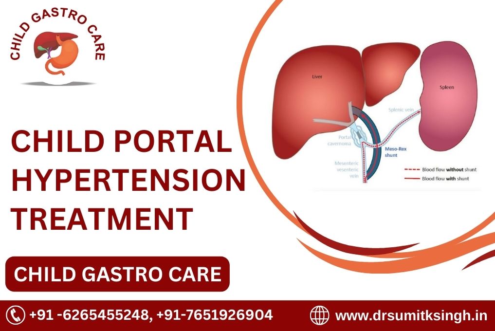 CHILD PORTAL HYPERTENSION TREATMENT IN INDORE