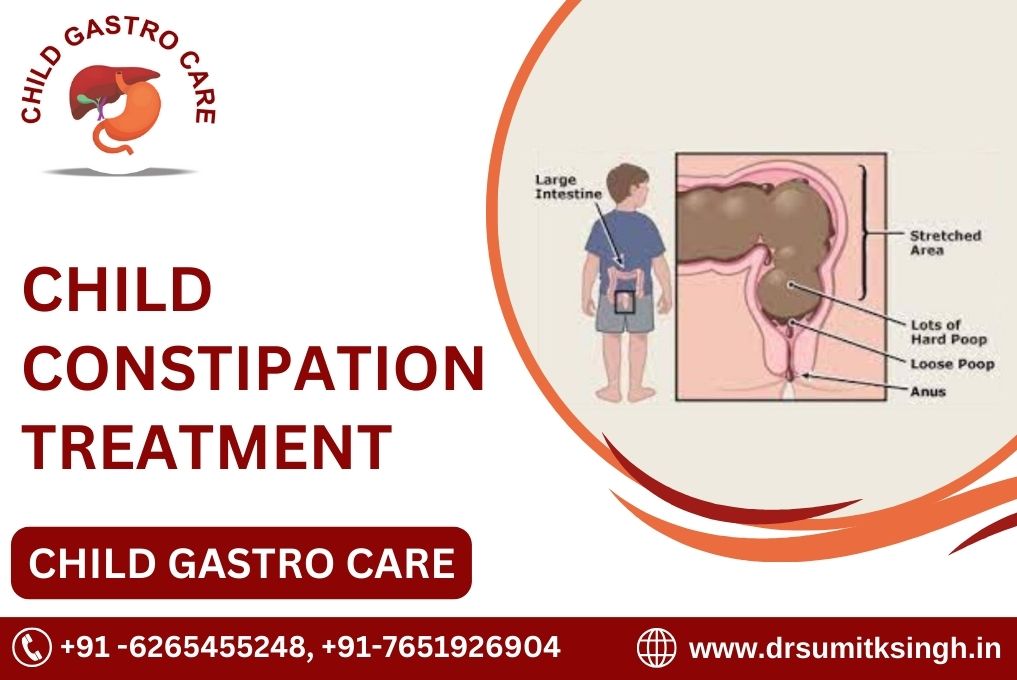 CHILD CONSTIPATION TREATMENT IN INDORE