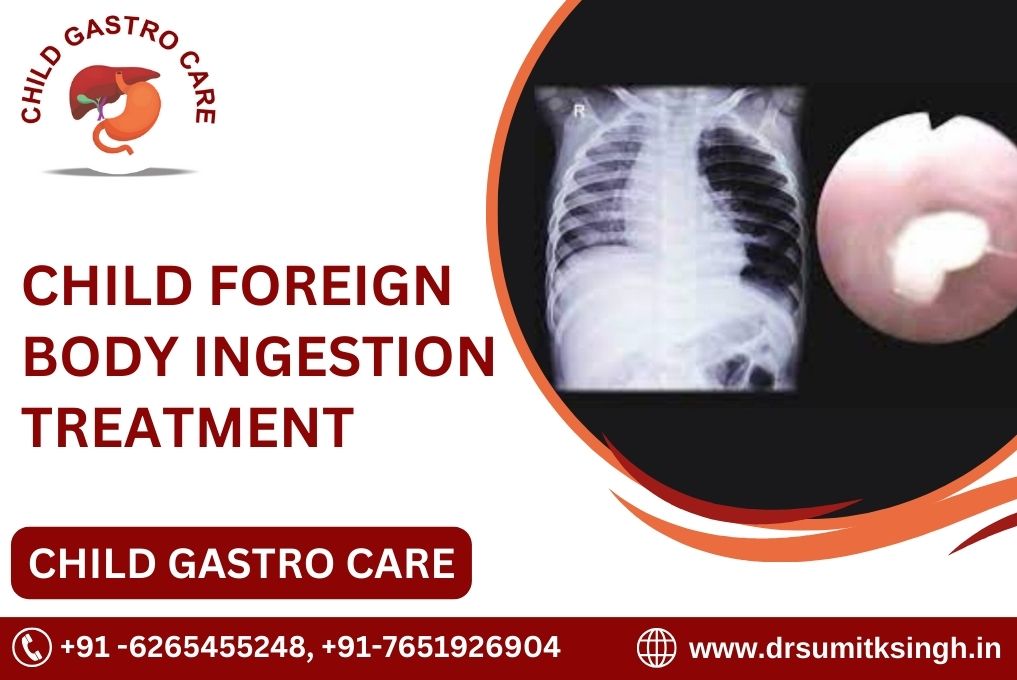 CHILD FOREIGN BODY INGESTION TREATMENT IN INDORE