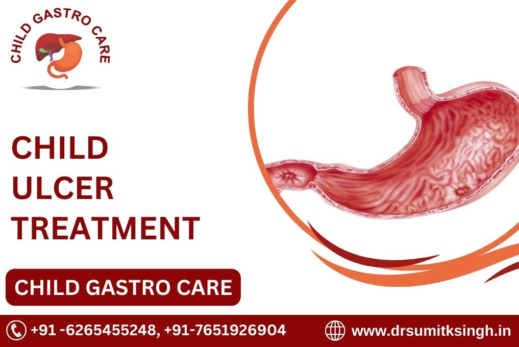 CHILD ULCER DISEASE TREATMENT IN INDORE