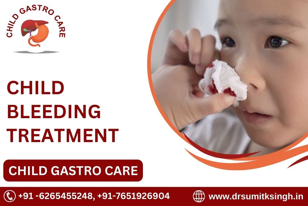 CHILD BLEEDING TREATMENT IN INDORE