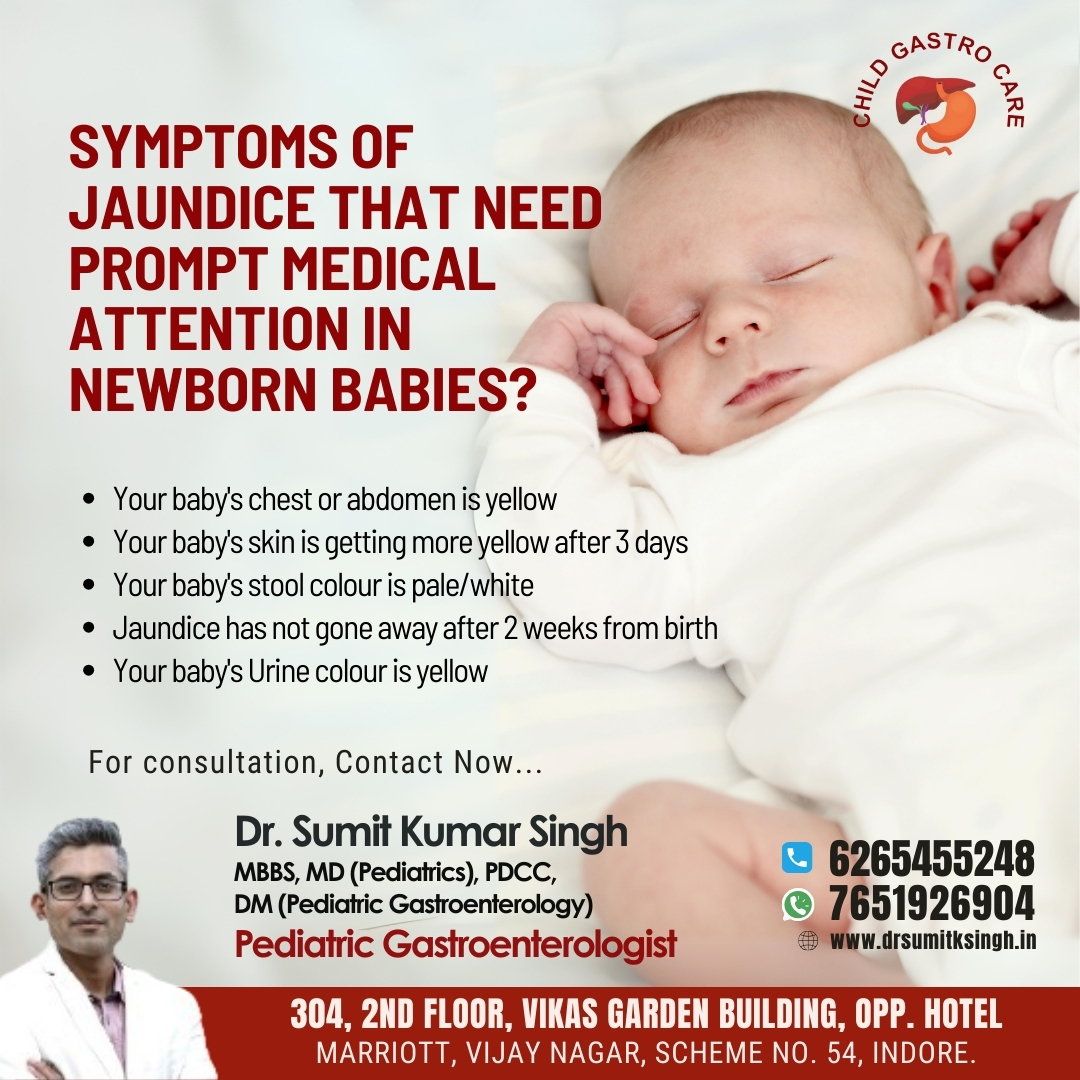 Jaundice Treatment Specialist In Indore