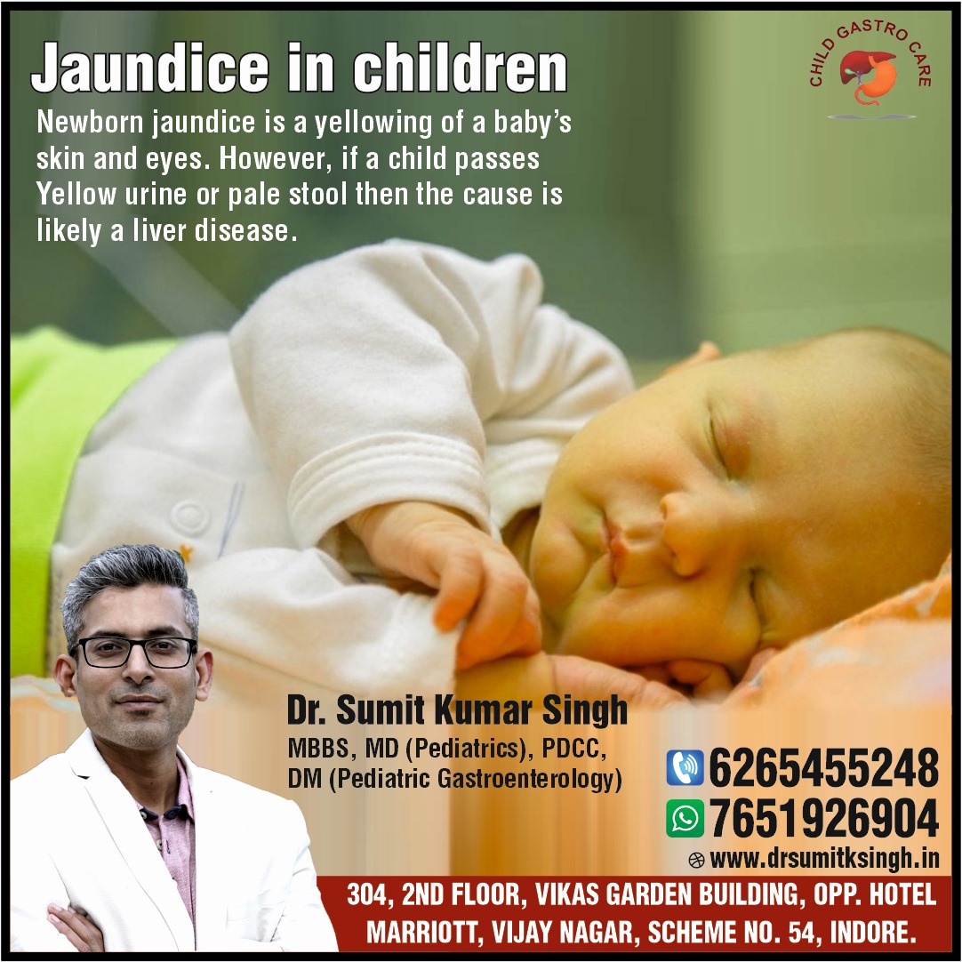 Best Doctor For Child Jaundice Treatment In Indore