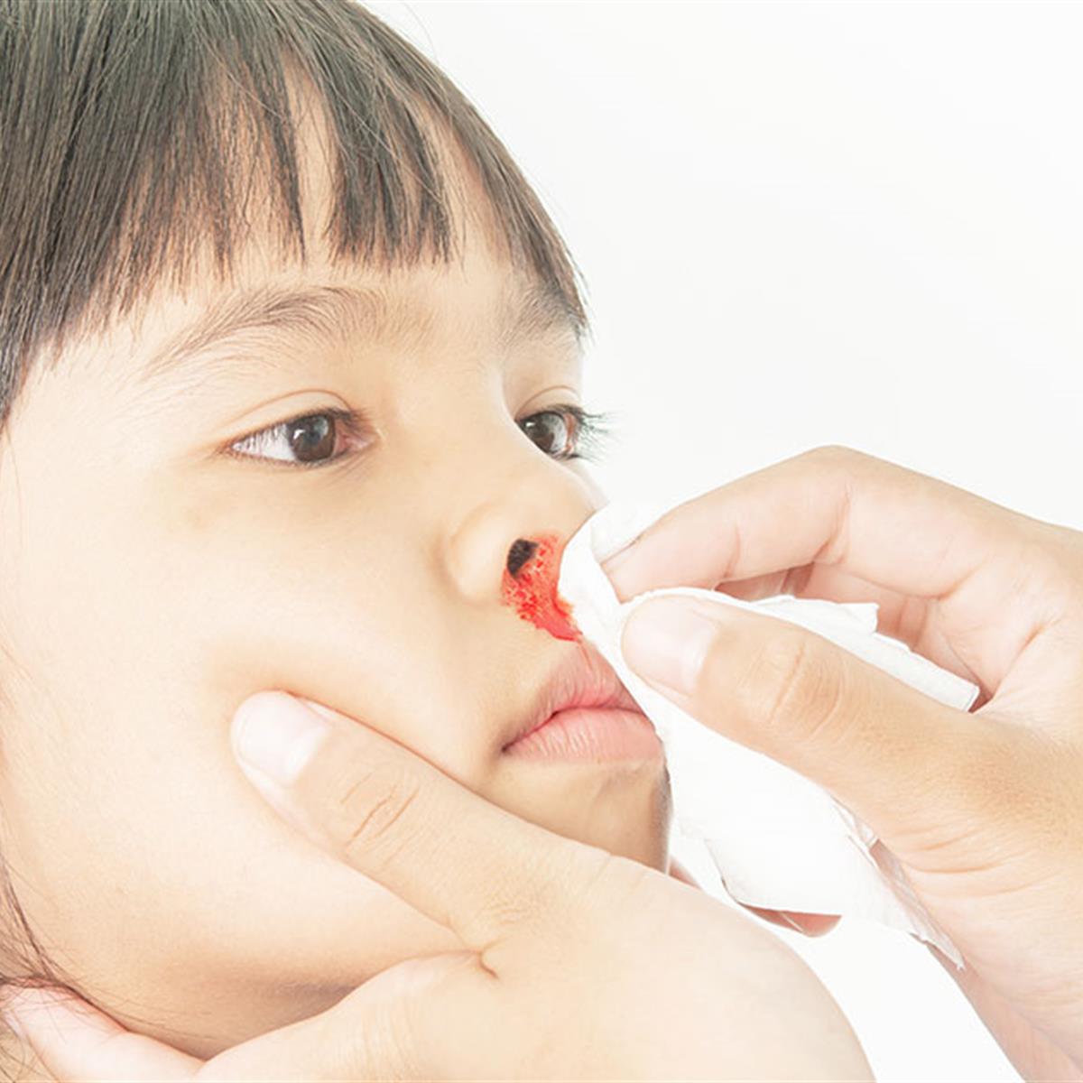 Best Child Doctor For Child Bleeding Treatment in Indore